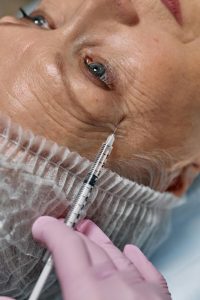 Botox tegenkraaienpootjes | Dreamclinics