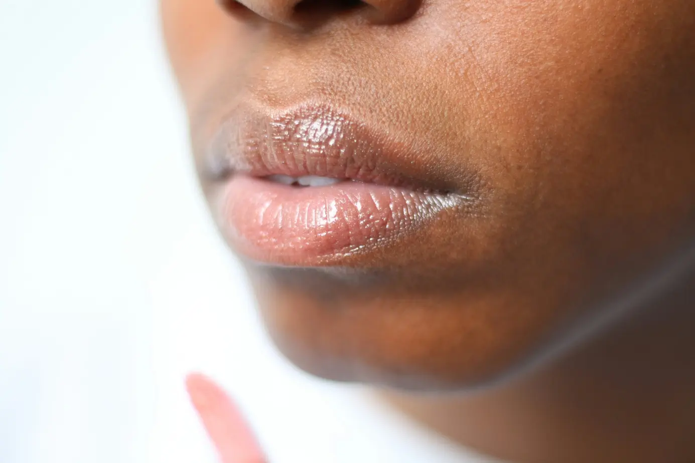 Botox vs. fillers: wat is het verschil?