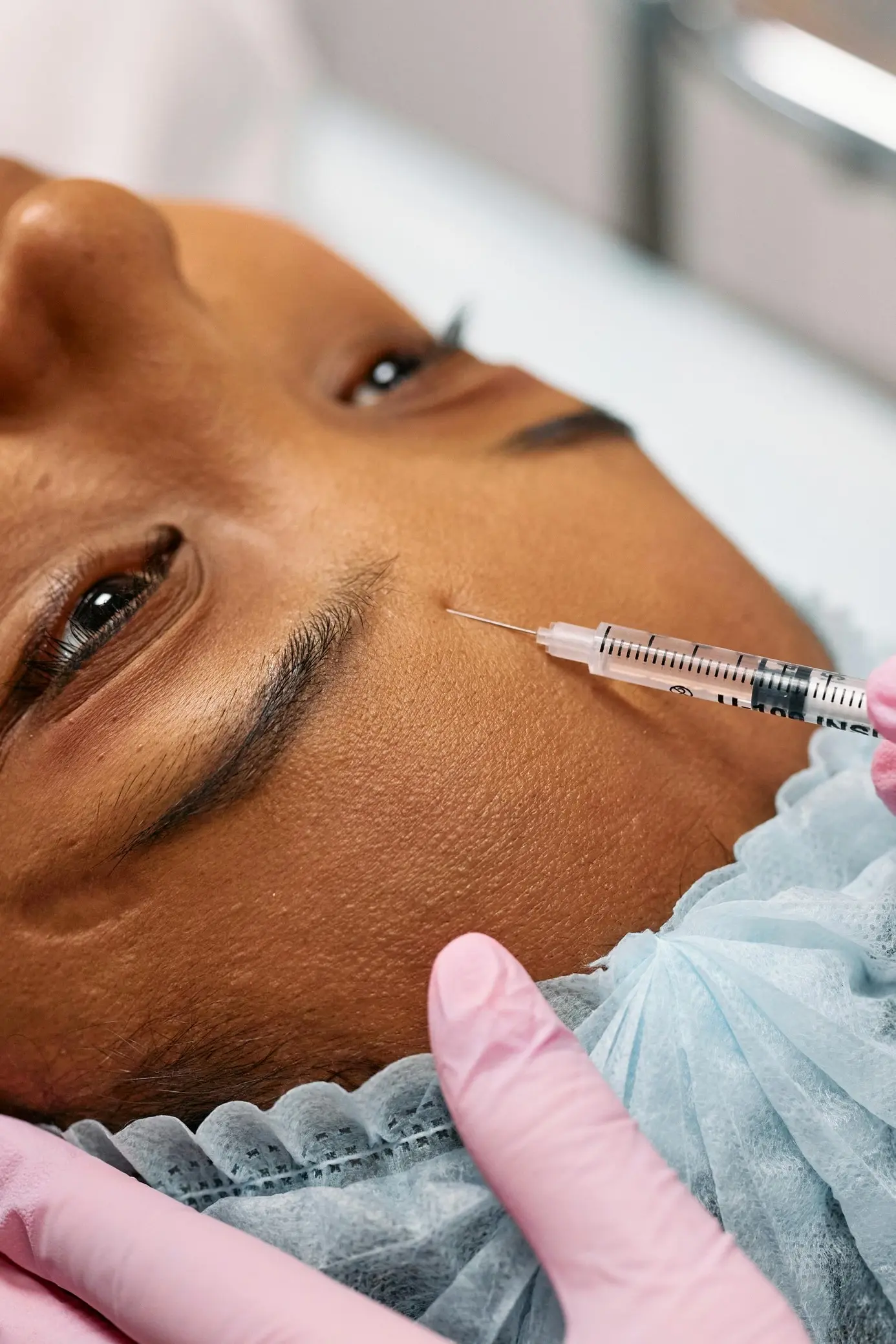 Wanneer werkt Botox en wat kun je verwachten na je behandeling