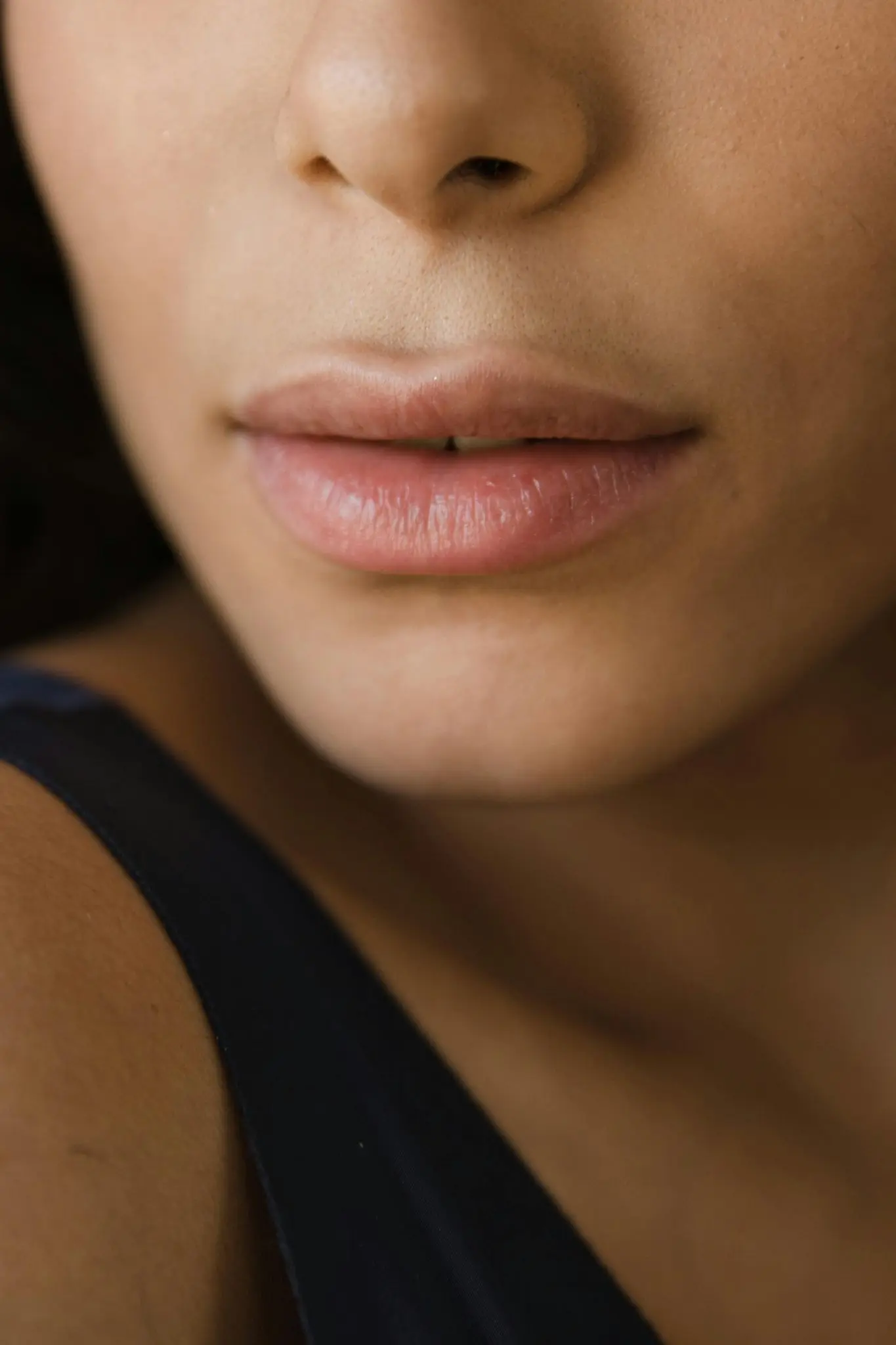 Natuurlijke lipfillers: een subtiele aanpak voor vollere lippen