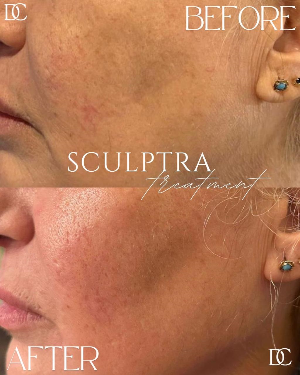 face-slimming dreamclinics